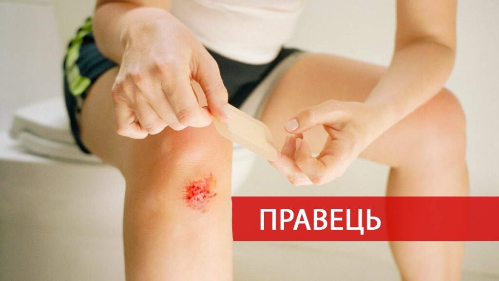 Що таке правець?